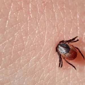 What Does a Tick Bite Look Like on a Human